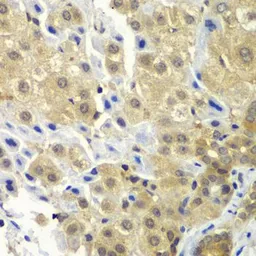 Anti-SGTA antibody used in IHC (Paraffin sections) (IHC-P). GTX55797