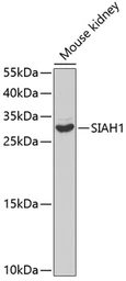 Anti-SIAH1 antibody used in Western Blot (WB). GTX55799