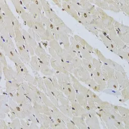 Anti-SNRPA antibody used in IHC (Paraffin sections) (IHC-P). GTX55804