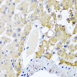 Anti-SULT1A1 antibody used in IHC (Paraffin sections) (IHC-P). GTX55811