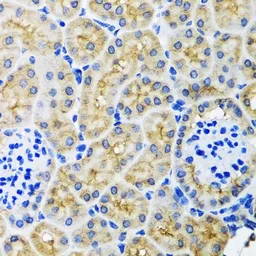 Anti-SULT1A1 antibody used in IHC (Paraffin sections) (IHC-P). GTX55811