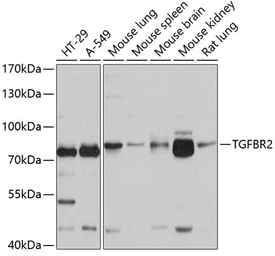 Anti-TGF beta Receptor 2 antibody used in Western Blot (WB). GTX55814