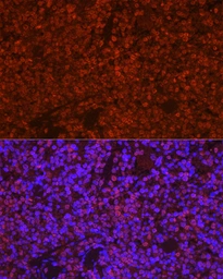 Anti-TMS1 antibody used in IHC (Paraffin sections) (IHC-P). GTX55818