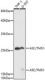 Anti-TMS1 antibody used in Western Blot (WB). GTX55818