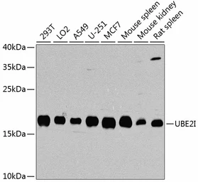 Anti-UBE2I antibody used in Western Blot (WB). GTX55830