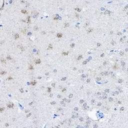 Anti-UBE3A antibody used in IHC (Paraffin sections) (IHC-P). GTX55832