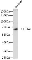 Anti-UGT1A antibody used in Western Blot (WB). GTX55835