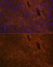 Anti-UGT1A antibody used in IHC (Paraffin sections) (IHC-P). GTX55835
