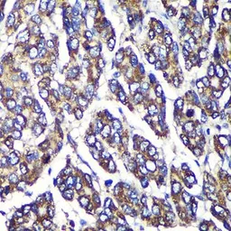 Anti-UGT1A antibody used in IHC (Paraffin sections) (IHC-P). GTX55835