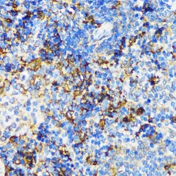 Anti-Visfatin antibody used in IHC (Paraffin sections) (IHC-P). GTX55840