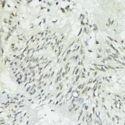 Anti-ZEB1 antibody used in IHC (Paraffin sections) (IHC-P). GTX55847