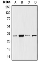 Anti-SIX3 antibody used in Western Blot (WB). GTX55892