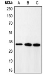 Anti-p35 antibody used in Western Blot (WB). GTX55905