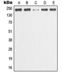 Anti-GANP antibody used in Western Blot (WB). GTX55906