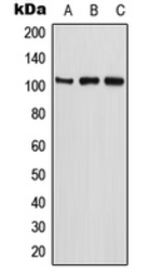 Anti-ETAA1 antibody used in Western Blot (WB). GTX55958