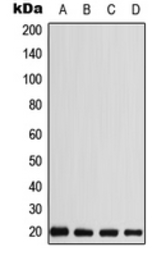 Anti-CABP5 antibody used in Western Blot (WB). GTX55964
