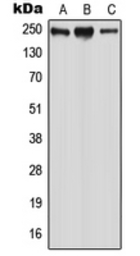 Anti-WNK2 antibody used in Western Blot (WB). GTX55972