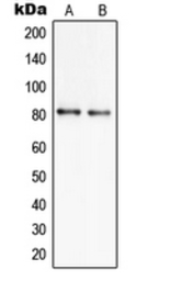 Anti-SLC6A17 antibody used in Western Blot (WB). GTX55991