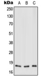 Anti-MT-ND3 antibody used in Western Blot (WB). GTX55994