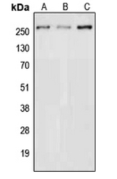 Anti-NAV3 antibody used in Western Blot (WB). GTX56018