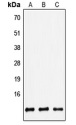 Anti-beta 2 Defensin antibody used in Western Blot (WB). GTX56023