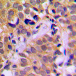 Anti-AChR alpha 1 antibody used in IHC (Paraffin sections) (IHC-P). GTX56028