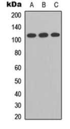 Anti-Enterokinase Light chain antibody used in Western Blot (WB). GTX56053