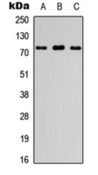 Anti-FIGNL1 antibody used in Western Blot (WB). GTX56054