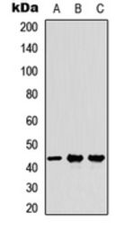 Anti-Milk Fat Globule 1 antibody used in Western Blot (WB). GTX56061