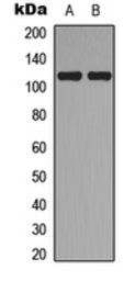 Anti-TOP3A antibody used in Western Blot (WB). GTX56078