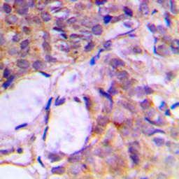 Anti-CNK2 antibody used in IHC (Paraffin sections) (IHC-P). GTX56090
