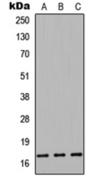 Anti-CST9L antibody used in Western Blot (WB). GTX56093