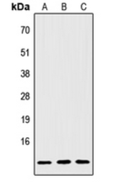 Anti-IGFL2 antibody used in Western Blot (WB). GTX56103