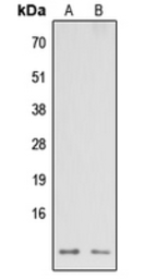 Anti-NDUFA3 antibody used in Western Blot (WB). GTX56108