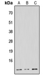 Anti-NDUFB1 antibody used in Western Blot (WB). GTX56109