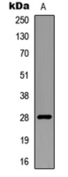 Anti-RNF138 antibody used in Western Blot (WB). GTX56117