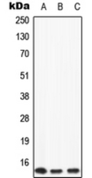 Anti-Apolipoprotein CII antibody used in Western Blot (WB). GTX56149