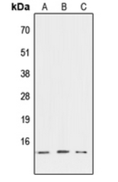 Anti-ATP6V1G3 antibody used in Western Blot (WB). GTX56218
