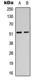 Anti-mAChR M1 antibody used in Western Blot (WB). GTX56224