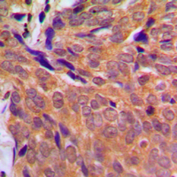 Anti-Chk1 antibody used in IHC (Paraffin sections) (IHC-P). GTX56248