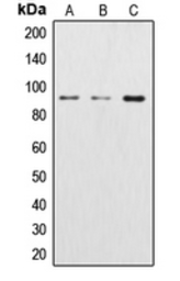 Anti-beta Catenin antibody used in Western Blot (WB). GTX56267