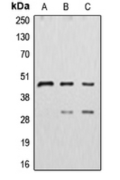 Anti-Cathepsin D antibody used in Western Blot (WB). GTX56269