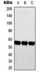 Anti-Cytochrome P450 2D6 antibody used in Western Blot (WB). GTX56287