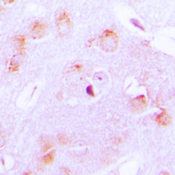 Anti-CYP17A1 antibody used in IHC (Paraffin sections) (IHC-P). GTX56294