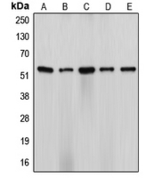Anti-CYP17A1 antibody used in Western Blot (WB). GTX56294