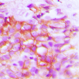 Anti-TRP2 antibody used in IHC (Paraffin sections) (IHC-P). GTX56299