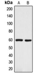 Anti-TRP2 antibody used in Western Blot (WB). GTX56299