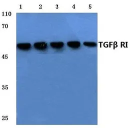 Anti-TGF beta Receptor I antibody used in Western Blot (WB). GTX57156