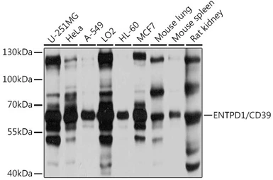 Anti-CD39 antibody used in Western Blot (WB). GTX57161