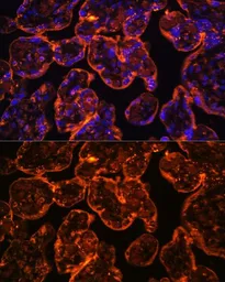 Anti-CD39 antibody used in IHC (Paraffin sections) (IHC-P). GTX57161